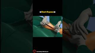 Heart Bypass Surgery Procedure  3D video  cardiology short [upl. by Giustino]