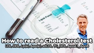 How to Read a Cholesterol Test LDL HDL Lpa Apoe sdLDL TGHDL ApoA1ApoB [upl. by Ruttger]