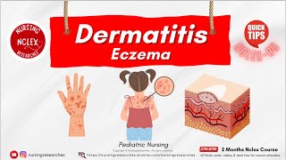 Dermatitis Eczema Pediatric Nursing Nclex Quick Tips [upl. by Debor478]