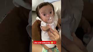 Nebulisation of 1 year old cute baby ❤️❤️🥹cutebaby reels babyshorts viralshorts [upl. by Faulkner157]