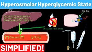 Hyperosmolar Hyperglycemic Nonketotic Syndrome  Panmedicad [upl. by Assyral960]