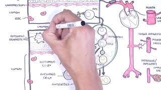 Vasculitis Pathophysiology Overview [upl. by Eiramit]