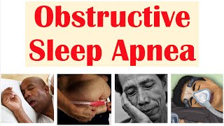 Obstructive Sleep Apnea OSA  Risk Factors Signs amp Symptoms Complications Diagnosis Treatment [upl. by Cottle]