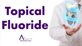 Benefits of Topical Fluoride [upl. by Aitsirt]