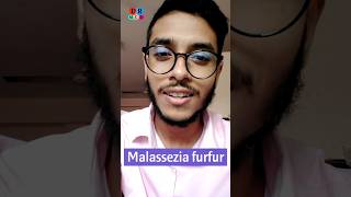 Dandruff  খুশকি  Fungal infection  Malassezia furfur  Dr Med  Sakib Rahaman [upl. by Aicil17]