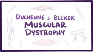 Duchenne amp Becker muscular dystrophy  causes symptoms treatment amp pathology [upl. by Jola]