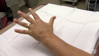 Mayo Clinic Minute What may be causing your hands and feet to tingle [upl. by Nnylkoorb552]