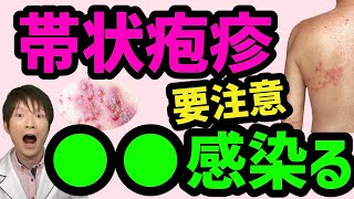 【要注意】伝染る可能性のある帯状疱疹の特徴！【総合内科専門医・監修】症状、原因、頻度、予防、治療についても解説！ [upl. by Hcaz]