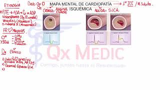 1 CARDIOPATÍA ISQUEMICA 1 [upl. by Corinna]