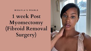 1 week Post Myomectomy Fibroid Removal Surgery [upl. by Tica]