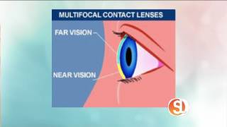 TIP Multifocal Contact Lenses [upl. by Reffinnej902]