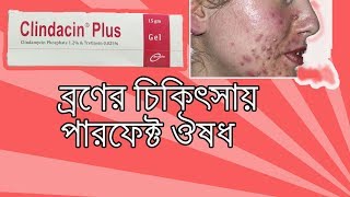 Clindacin Plus Gel  what is clindamycin gel used to treat Bangla [upl. by Nnylidnarb]