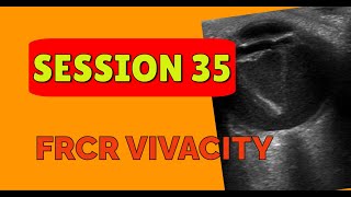 FRCR VIVACITY SESSION 35 [upl. by Austine]