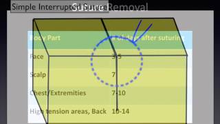 Suture Removal A Video for Patients [upl. by Abernon]