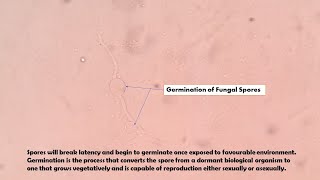 Germination of Fungal Spores Demonstration [upl. by Nueoht213]