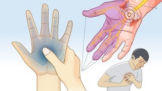 What Causes Tingling and Numbness in Hands and Feet [upl. by Lainahtan923]