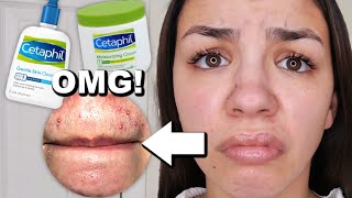 I Used Cetaphil Skincare For One Week [upl. by Euqenimod]