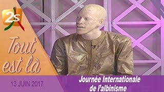 JOURNÉE DE LALBINISME LES PROBLÈMES RENCONTRÉS PAR LES ALBINOS AU SÉNÉGAL  TOUT EST LÀ DU 13 JUIN [upl. by Kristo]