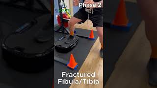 Fractured Fibular and Tibia How to Build Leg Strength With WholeBody Vibration amp BFR Bands [upl. by Acinonrev]