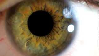 Close up eye and pupil dilation [upl. by Bloomer]