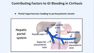 Esophageal Varices and Variceal Hemorrhage [upl. by Eca]