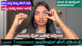 Laser Treatment Review in Kannada  ಈಗ ನನ್ನ ಕಣ್ಣು ಹೇಗ್ ಇದೆ [upl. by Oivat]