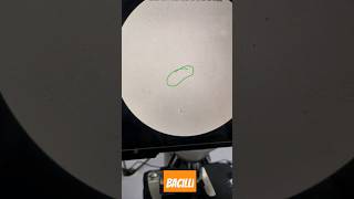 Bacilli in urine Microscopy microscope digitalmicroscope laboratory medical viralshorts music [upl. by Ertha]