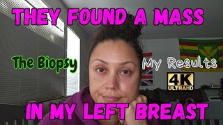 They Found A Mass In My Left Breast  My Biopsy  The Results  Biopsy Mammogram BreastHealth [upl. by Walford]