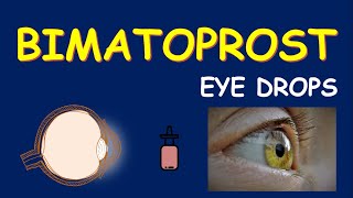 Bimatoprost eye drops  For eyelash and glaucoma [upl. by Cony]