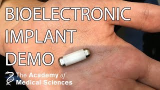 Bioelectronic implants demonstration  Professor Kevin Tracey [upl. by Ecyla458]