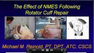 Neuromuscular Electrical Stimulation for the Rotator Cuff  Mike Reinold [upl. by Alliuqal]