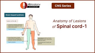 Anatomy of Lesions of spinal cordPart 1 [upl. by Aroled946]