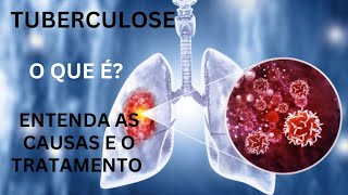 TUBERCULOSE O QUE É ENTENDA AS CAUSAS SINTOMAS E TRATAMENTOS [upl. by Notsuh]