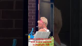 MAN WALKING AROUND WITH BRAINS EXPOSED IN NASHVILLE TN [upl. by Iahcedrom]