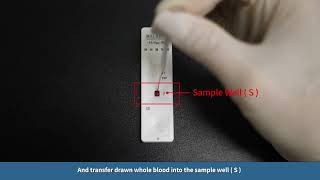 AccuTell® Malaria Pf pan Cassette Whole Blood  English [upl. by Revilo865]