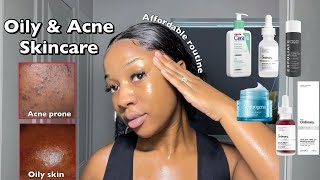 SKINCARE ROUTINE FOR OILY ACNEPRONE SKIN  A routine for smooth amp clear Skin ‼️ [upl. by Sadiras981]