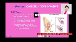 DUCTAL CARCINOMA IN SITU [upl. by Yliram494]