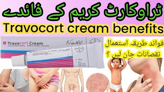 Travocort creamuses benefits inurduhindi for yeast fungal skin rashes allergyami review [upl. by Salis966]