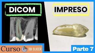 De DICOM a STL  Segmentación de tomografías con 3D Slicer  Curso COMPLETO parte 7 [upl. by Latoyia]