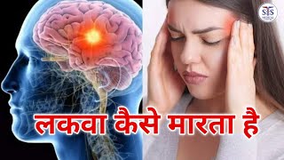 lakva kaise marta hai लकवा कैसे मारता है paralysis medical 3danimation study lakva explore [upl. by Naara]