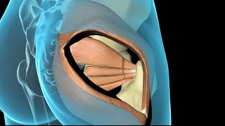 Total Hip Replacement [upl. by Cate]