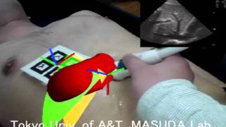 3D body mark using AR technology [upl. by Nimad]