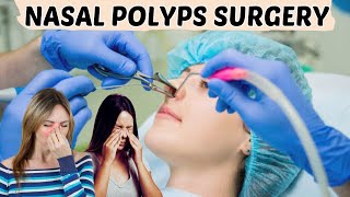 Nasal Polyps Treatment  Nasal Surgery  Nasal Polyps ENT Lecture [upl. by Lokkin]