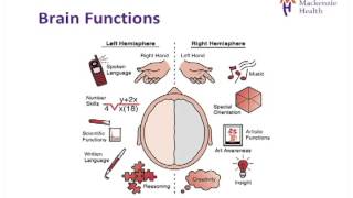 Stroke Education  Causes and Effects [upl. by Tolecnal]