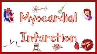 Myocardial InfarctionHeart Attack Causes Pathogenesis Signs amp Symptoms Diagnosis amp Treatment [upl. by Davida]