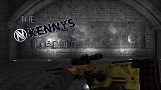 KennyS Loadout  CSGO Pro Loadouts [upl. by Sayed]