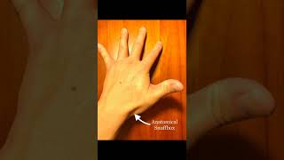 scaphoid fracture كسر العظمة الزورقية [upl. by Rebma]