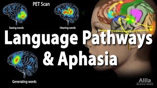 Language Pathways and Aphasia Animation [upl. by Mingche]