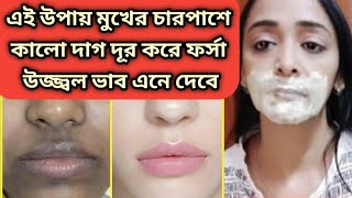 মুখের চারপাশে কালো দাগ ছোপ দূর করে ফর্সা ভাব আনবেRemove Dark Patches Around Mouth 100 Results [upl. by Feinstein]