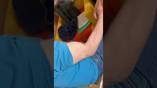 Biceps tendon rupture bicepsworkout bicepstendonrupture biceps workout properworkout doctor [upl. by Wendin]